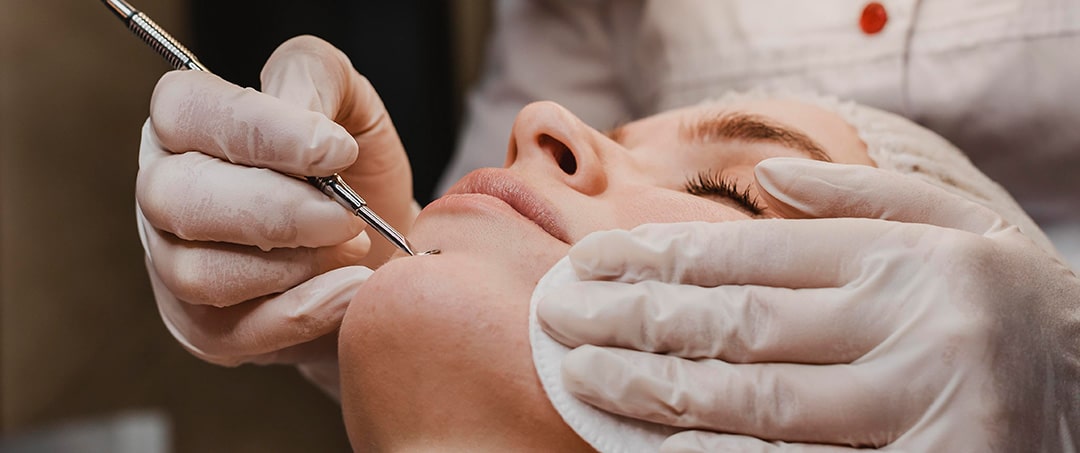 EGO SKINCARE | EGO Clear Balance – behandling til voksen hud med akne EGO SKINCARE|EGO Clear Balance – behandling til voksen hud med akne