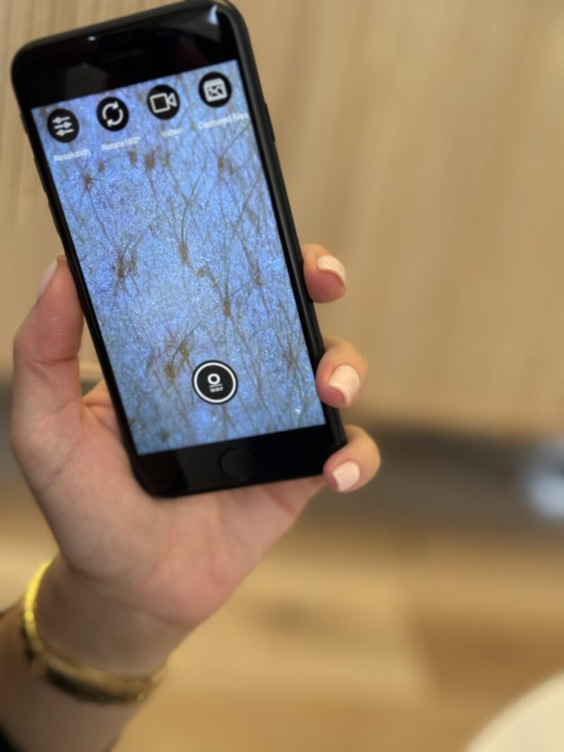 hudanalyse i EGO Skincare